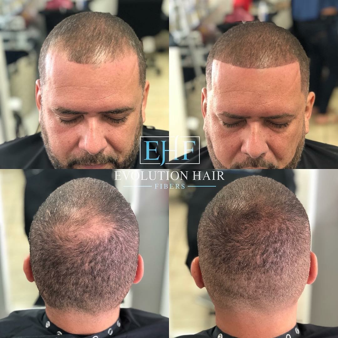 Evolution Hair Fibers 100 Natural Hair Fibers Conceal Thinning Hair